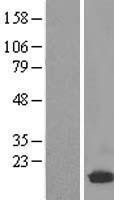 NBL1-17519 - UBE2D2 Lysate