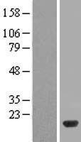 NBL1-17520 - UBE2D2 Lysate