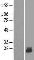 NBL1-17523 - UBE2D4 Lysate