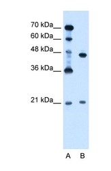 NBP1-55077 - UBE2E2