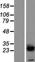 NBL1-17524 - UBE2E2 Lysate