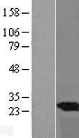 NBL1-17526 - UBE2E3 Lysate