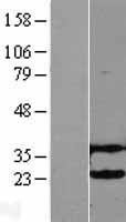 NBL1-17531 - UBE2H Lysate