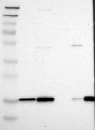 NBP1-86887 - UBC9 / UBE2I