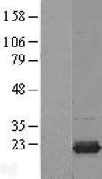 NBL1-17533 - UBE2I Lysate