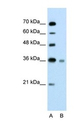 NBP1-59757 - UBE2J1