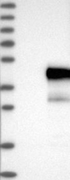 NBP1-85654 - UBE2J1