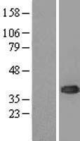 NBL1-17534 - UBE2J1 Lysate