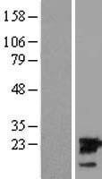 NBL1-17540 - UBE2M Lysate