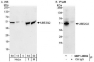 NBP1-49694 - UBE2Q2