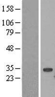NBL1-17544 - UBE2S Lysate