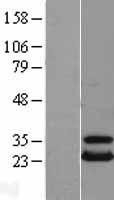 NBL1-17545 - UBE2T Lysate