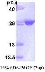 NBP1-44487 - UBE2T