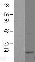NBL1-17549 - UBE2W Lysate