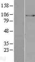 NBL1-17551 - UBE3A Lysate