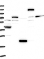 NBP1-81558 - UBE3C