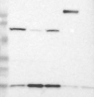 NBP1-84956 - UBL4A / GDX