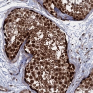 NBP1-85468 - UBLCP1