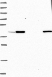 NBP1-85468 - UBLCP1