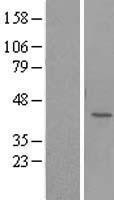NBL1-17558 - UBLCP1 Lysate