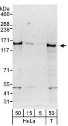 NBP1-49983 - Ubinuclein-1 (UBN1)