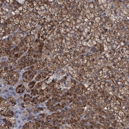 NBP1-82842 - UBP1 / LBP1