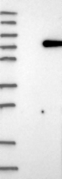 NBP1-82842 - UBP1 / LBP1