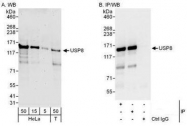 NBP1-50001 - USP8 / UBPY