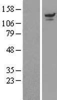 NBL1-17672 - UBPY/USP8 Lysate