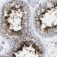NBP1-86896 - Ubiquilin-3 (UBQLN3)