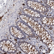 NBP1-82737 - Ubiquilin-like protein