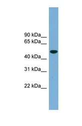NBP1-57057 - Ubiquilin-like protein