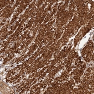 NBP1-88759 - UBR2