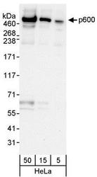 NBP1-28724 - UBR4