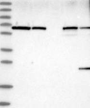NBP1-92560 - UBXN4 / UBXD2