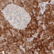 NBP1-87018 - UBXN11 / UBXD5