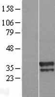 NBL1-17572 - UBXN10 Lysate