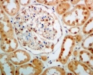 NBP1-95831 - UCHL5