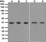 NBP1-95831 - UCHL5