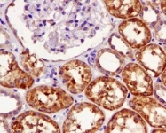 NBP1-95618 - UCHL5