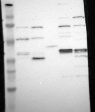 NBP1-85656 - UCHL5