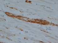 NB100-65827 - UCHL1 / PGP9.5