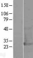 NBL1-17575 - UCHL1 Lysate