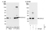 NBP1-49711 - UCHL3