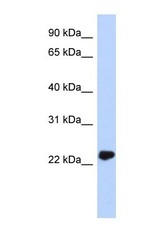 NBP1-55316 - UCHL3