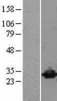 NBL1-17576 - UCHL3 Lysate