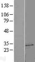 NBL1-17580 - UCK2 Lysate