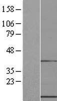 NBL1-17589 - UFM1 Lysate