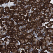 NBP1-81651 - UGCGL1 / RUGT
