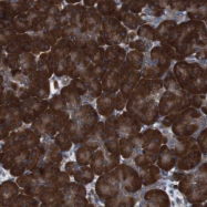 NBP1-81652 - UGCGL1 / RUGT